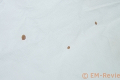 EM-Reviews_Tatuajes_Verrugas_Eliminar_con_Kayboo6528